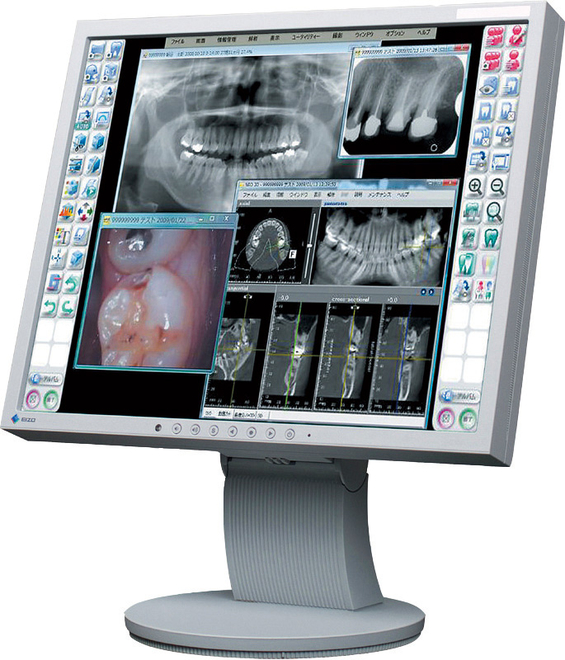 歯科用デジタル画像情報ソフトウェア