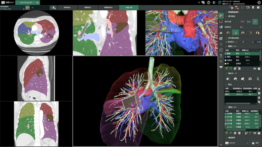 3次元画像解析システム