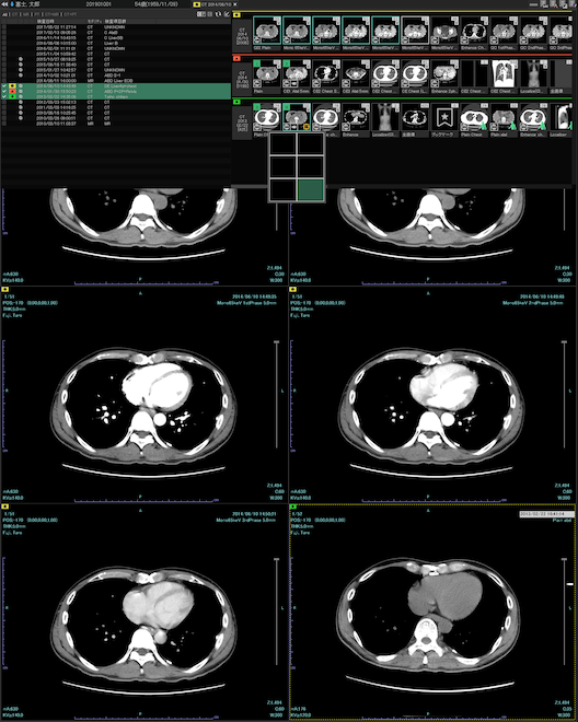 画像診断ワークステーション