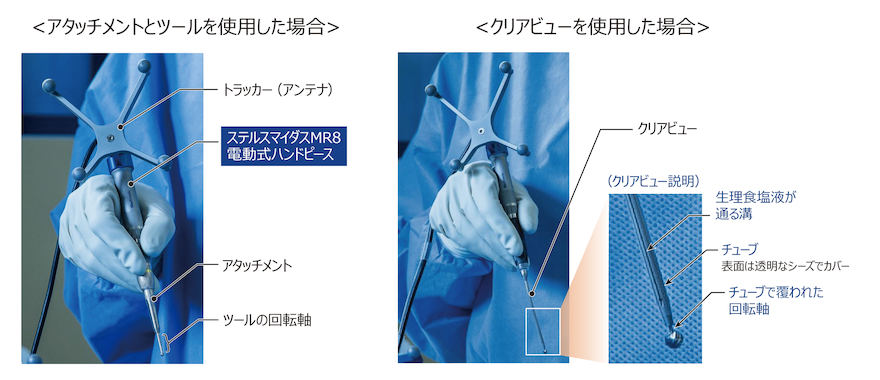 ハンドヘルド光療法デバイス ハンドヘルド光療法デバイス