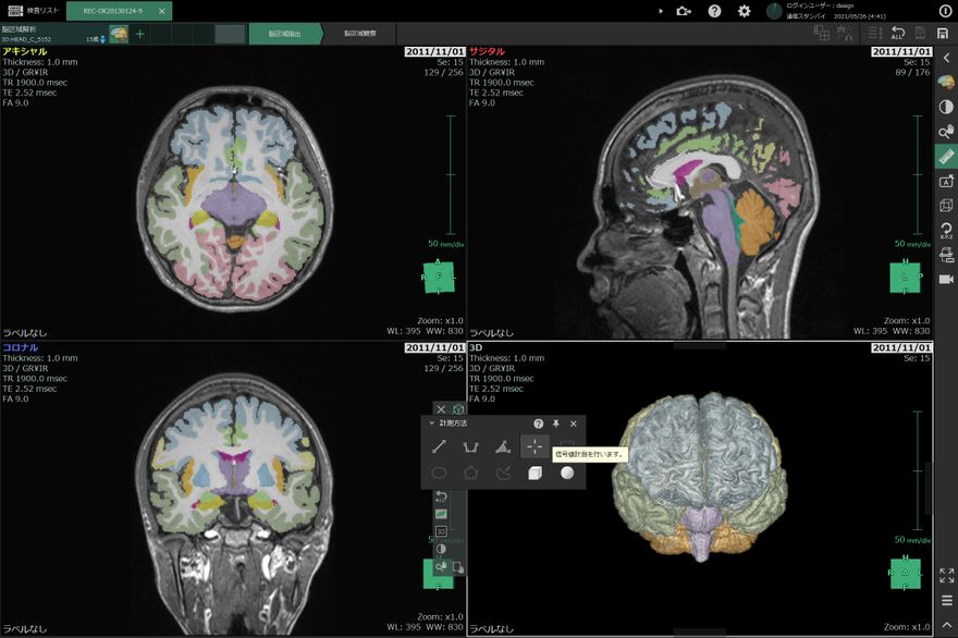 3次元画像解析システム