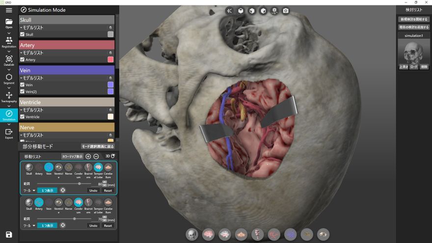 医療用3Dワークステーションで学ぶ 脳神経外科手術戦略シミュレーション Amazon.co.jp: 医療用3Dワークステーションで学ぶ 脳神経外科