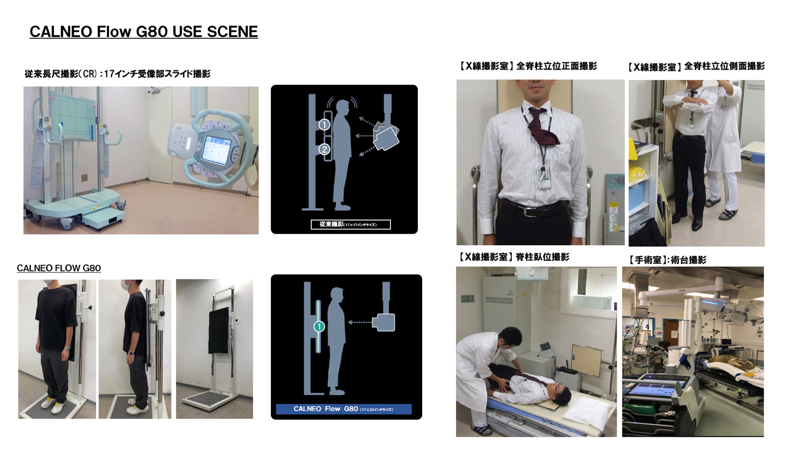 デジタルX線画像診断装置