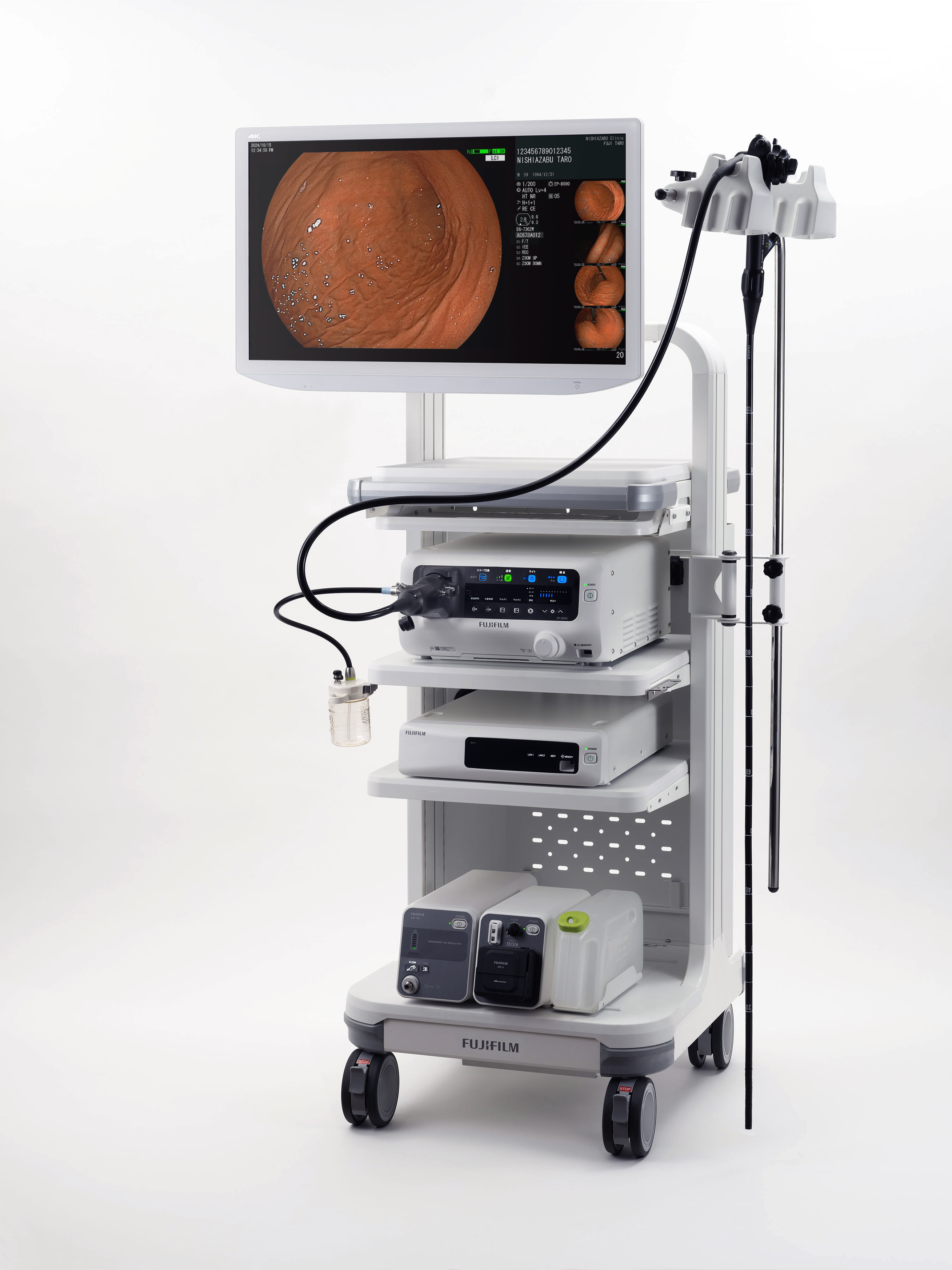 電子内視鏡システム