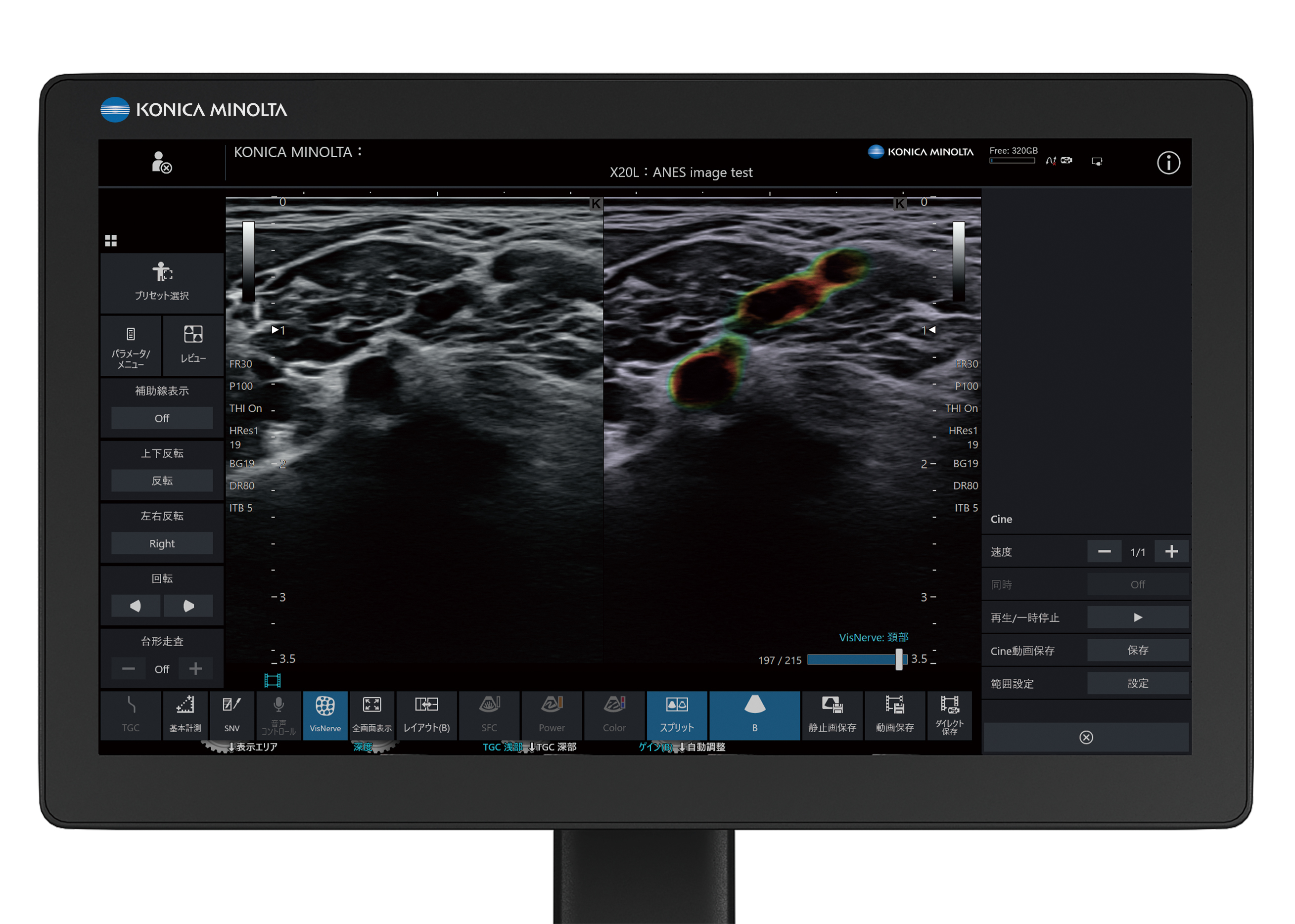 汎用超音波画像診断装置